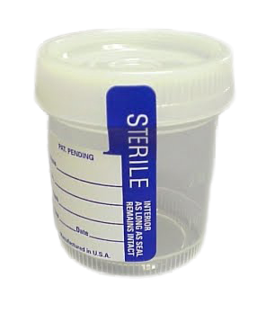 90ml_Sterile_urine_cup-copy